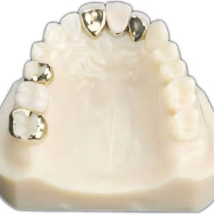 ヒューマンブリッジ治療のイメージ