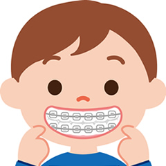 矯正歯科のイメージ